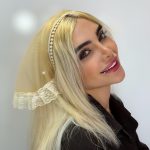 نمای دیگر تل اسکارفی